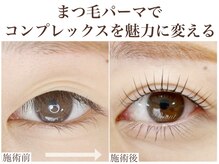 リアン(Riant)