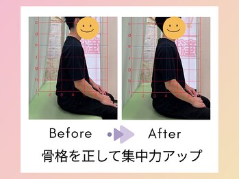鈴木接骨院 泉区将監院/骨格矯正について