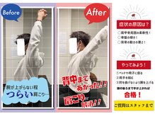 ナオル整体 札幌白石院(NAORU整体)/ビフォーアフター４