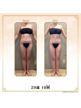 ベルシア 吉祥寺店(BELCIA)/