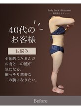レディラック 大阪梅田本店(Lady Luck)/マイクロウェーブリフトコース