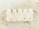 【ハンド】★定額Sコース 