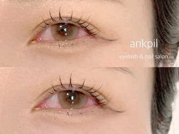 アノカプイル(ankpil)/