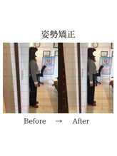 心斎橋長堀フェムテック整骨院/48姿勢矯正　骨格矯正と骨盤矯正