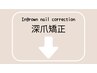 深爪矯正・自爪育成クーポン　～口コミ・ブログもチェック～