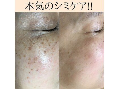 パルサロン(palsalon.)の写真