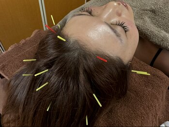 カラー(Calla)/頭皮鍼