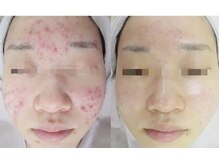 スリリアン 銀座/★お客さまビフォーアフター★