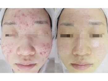 スリリアン 銀座/★お客さまビフォーアフター★