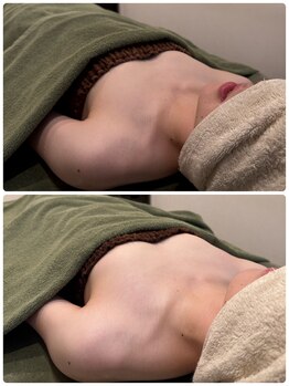 ビープラス(B+)/Before＆after