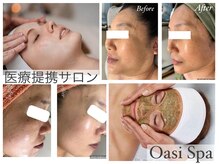オアジスパ(Oasi Spa)