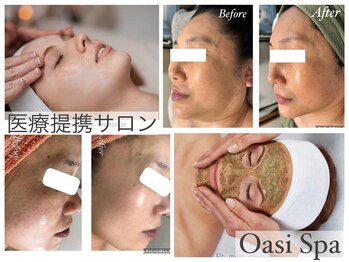 オアジスパ(Oasi Spa)