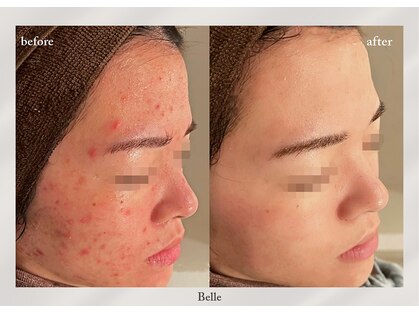 ベル 新橋(Belle)の写真