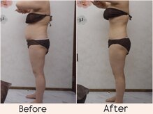 エステティックサロン ルテラの雰囲気（エステルーム）