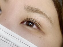 ピミル(PIMIL)/うなじ脱毛