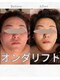 吉乃 大和高田有井店の写真/二重あご・たるみ改善◎フェイスラインすっきり！大和高田で小顔フェイシャル/マイクロウェーブリフト