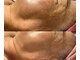 ピュリフィケーション(Purification)の写真