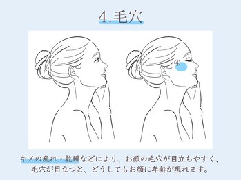 シーズ ラボ 立川店/毛穴