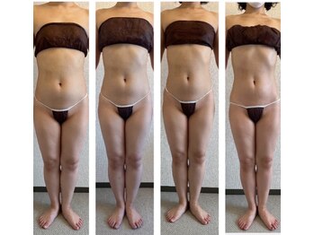 サロン ド カシェット 銀座/お客様のビフォーアフター例