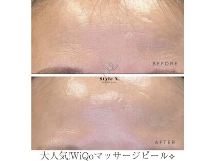 スタイルエヌ バイナース(Style N. by nurse)の写真