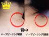 【徹底背中ケア】背面ハーブピーリング+肌別パック¥8900《1回で即効果実感》