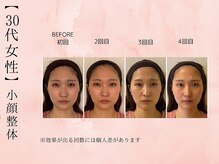 サクラ(SAKURA)/【30代】BeforeAfter