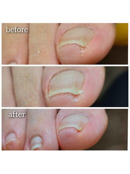 爪切り屋 足楽/