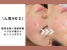 【人気no2】肌質診断×肌質改善《プロが選ぶ》クリスティーナピーリングケア