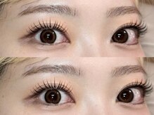 ヴィジョン(vision)