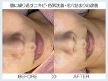 フェアリー(fairy)/