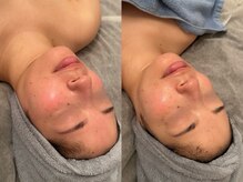 ポーデベロア(Peau des velours)/かぼちゃピール