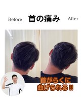 三条かがやき整体院/首の痛み改善