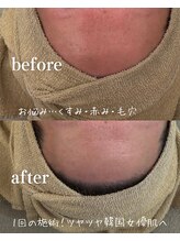 紬/before after