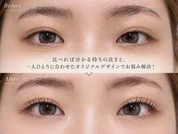 アイラッシュバーリー バイ ノブグループ(EYE LASH BARLEY by NOB GROUP)/伸びる自まつげ【まつげパーマ】