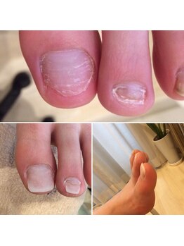 エムクチュール/正しいネイルケアで綺麗なお爪に