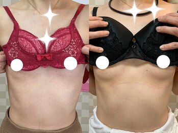 ハレオラ(HaleOla)/お客様の変化☆バストケア