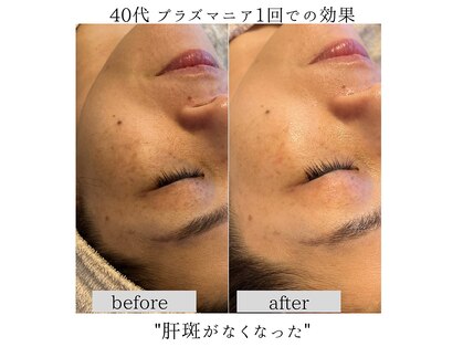 ビマリア(美-MARIA)の写真
