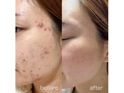 トータルビューティーサロン ティティ(Titi)の写真