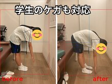 そらまめ接骨院/スカイビーンズ(SkyBeans)/学生のケガ