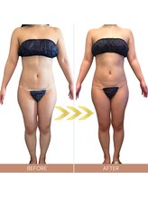 パルフェット(parfaite)/インディバ＆次世代マシン