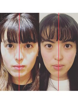 マダー(madder)/小顔矯正