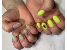 ディム(dim)/パラジェル/フィルイン