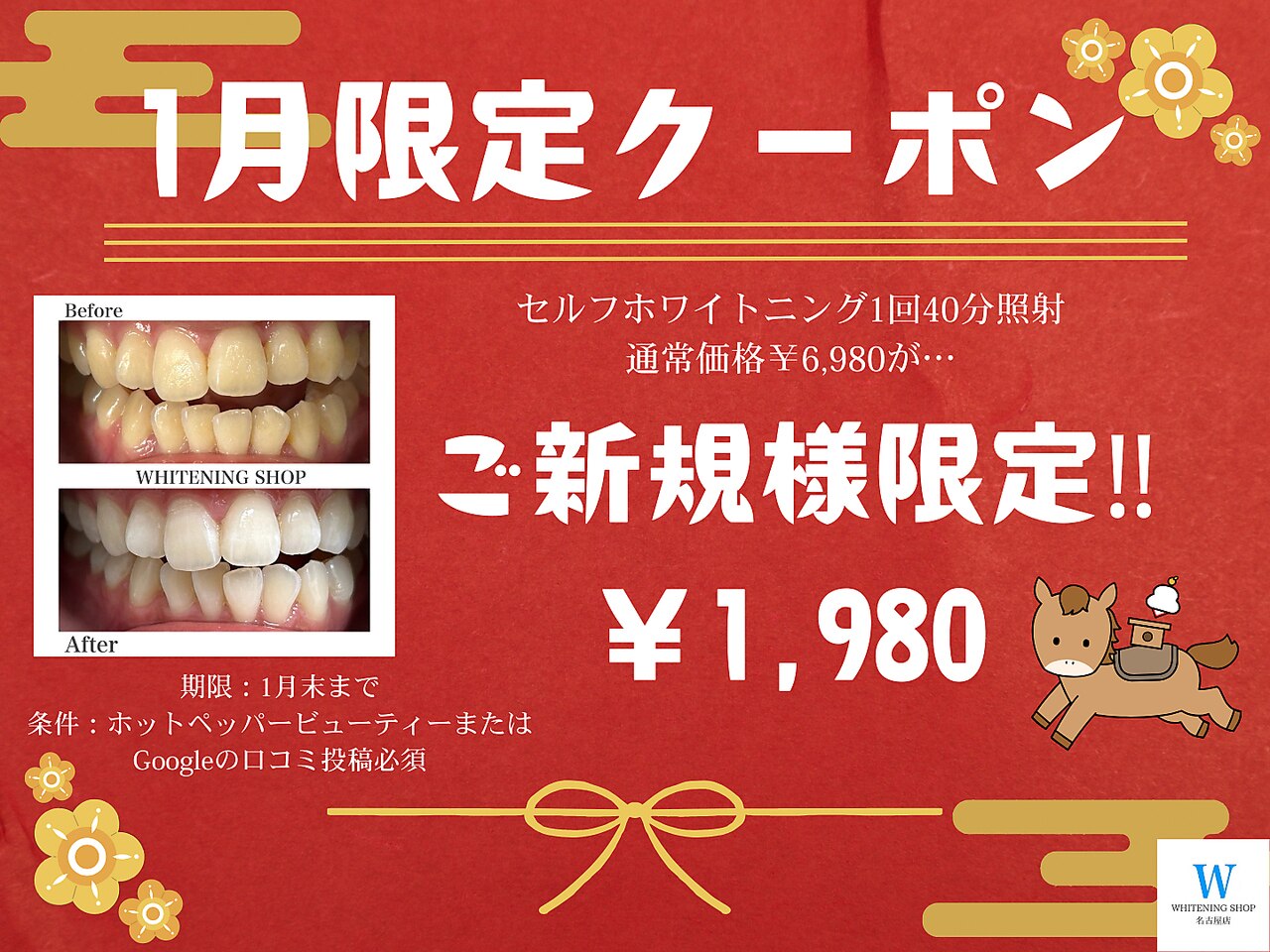 ホワイトニングショップ 名古屋店｜ホットペッパービューティー