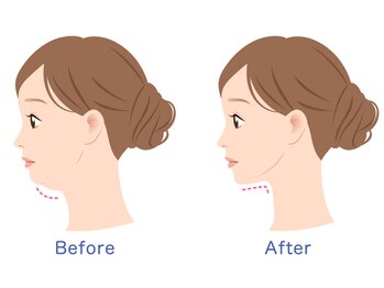 アジュ(Aju)/四角くなる輪郭に効果的
