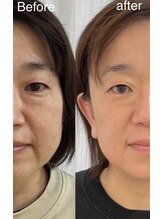 ココロニコル 今治店/今治初　幹細胞肌育成ケアLit