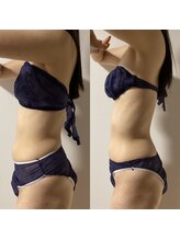 ベリッシマ筋膜セラピー/胴が伸びる？