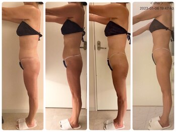 サロン ド カシェット 銀座/お客様のビフォーアフター例