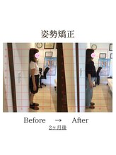 心斎橋長堀フェムテック整骨院/47姿勢矯正　骨格矯正と骨盤矯正