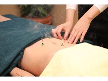 銀座 はり香/鍼灸で深部のこりをほぐす