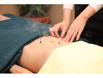 銀座 はり香/鍼灸で深部のこりをほぐす